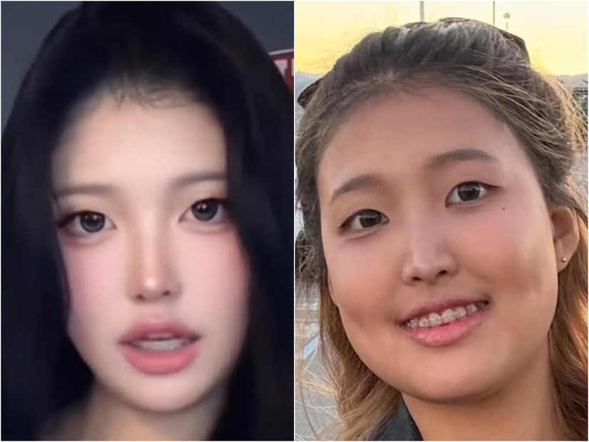 許可なく17歳娘の“変化前後”をSNSに掲載、娘の疑惑に韓国タレント母の対応が素晴らしいと賞賛