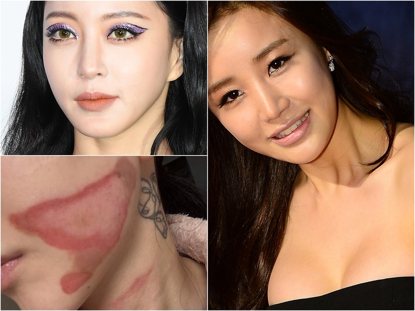 整形に美容施術、もはや“美”は金で買う時代　その裏に潜むリスクに直面した韓国芸能人たち