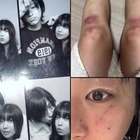 “デートDV被害”を暴露→立場を翻した韓国女性ラッパー、加害者と指名した元恋人と復縁を示唆 画像