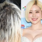 髪の90%が抜け落ち“対人恐怖症”にもなったDJ SODA、ブリーチ事故から1年…最新の髪型公開 画像