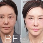 限界ギリギリまで整形、60代とは思えないビジュアルに！韓国ベテラン女優の潔すぎる告白が話題 画像