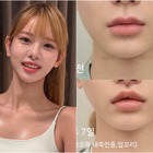 12年ぶりの整形は人中短縮「ママには内緒で」“韓国で最もグラマラス”な元芸人（40）が理由明かす 画像