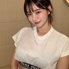“韓国で最もグラマラス”な元芸人が12年ぶりに整形　手術1カ月後の顔を公開「満足度は…」 画像