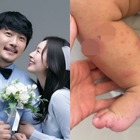 韓国人夫のために日本国籍を捨てた女性、生後8カ月の息子が手足口病に「先輩ママの話が聞きたい」 画像