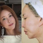 横浜で生まれ育った元韓国トップアイドル、自身もショックを受けた外見の変化「私の顔どうした」 画像