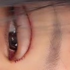 「地獄から」痛々しい手術痕…3度目となる目の整形手術を報告、父は元巨人投手の韓国インフルエンサー 画像