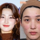 「育ててるのは元夫でしょ」元韓国アイドル、“育児で”ボロボロになった肌公開も視聴者は不快感 画像
