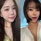 「整形してもブス」“元カレは日本人”の韓国豊胸芸人と、中2から整形のユーチューバーが語る「顔を変えたメリット」 画像