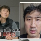 妻のDVで夫の眼球は破裂寸前に…“10カ月スピード婚”の韓国夫婦に起こった悲劇「離婚した方がいい」 画像