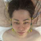 「こわっ！」ノンスタ井上、美容施術中のショット公開し反響 画像