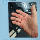 暴行の跡まで!! Ｊリーグのパワハラ問題に匹敵するか。韓国“ランシュー界の帝王”パワハラ事件の真相はいかに 画像