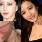 整形に美容施術、もはや“美”は金で買う時代　その裏に潜むリスクに直面した韓国芸能人たち 画像