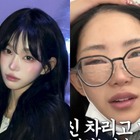 父は元巨人投手 韓国インフルエンサー、整形手術後の腫れた顔を赤裸々に公開 画像