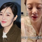 別人級に腫れた顔…『キム秘書』女優ファン・ボラ（42）、体外受精の副作用で健康悪化「体はボロボロ」 画像