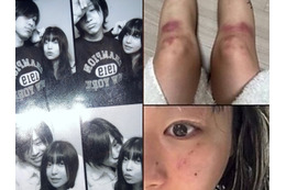 “デートDV被害”を暴露→立場を翻した韓国女性ラッパー、加害者と指名した元恋人と復縁を示唆 画像