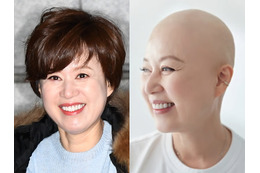 ファンのBTSに言及中に…韓国タレント、抗がん剤治療の副作用を吐露「目があまり見えなくなった」 画像