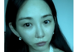 顔面に大やけど負ったクォン・ミナ、激変した近況に心配の声「かなり痩せたのでは」 画像