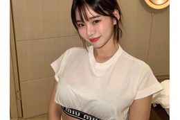“韓国で最もグラマラス”な元芸人が12年ぶりに整形　手術1カ月後の顔を公開「満足度は…」 画像