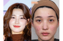 「育ててるのは元夫でしょ」元韓国アイドル、“育児で”ボロボロになった肌公開も視聴者は不快感 画像