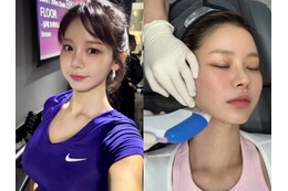 “韓国で最もグラマラス”と言われた元芸人、医師の年下彼氏に顔をお任せ！美容施術VLOGが話題 画像