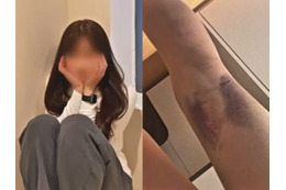 ストーカー被害の末に転落死…加害者姉のドラマ出演めぐり放送局が公式回答、遺族との“ズレ”露呈 画像