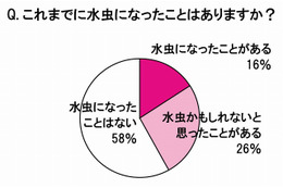 女性の水虫調査、半数が店で薬購入恥ずかしい……経験者4分の1が実際に買えず 画像