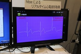 【NTT R&Dフォーラム2014 Vol.2】弱点は胸毛……ウェアラブル生体センサーを東レと共同開発 画像