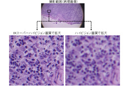 8K技術で遠隔医療！NTTデータ経営研究所らが実証実験へ 画像