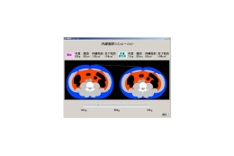 日立、体重と腹囲から腹部の疑似断層画像を表示するメタボ対策支援技術 画像