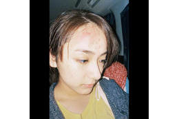 平祐奈の痛々しいメイク姿に「一瞬、ビックリ」「技術半端ない」の声! 画像