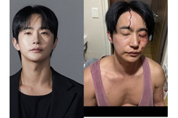 「性病をうつされ暴力もあった」と告発された韓国俳優が反論「彼女に殴られた」 画像
