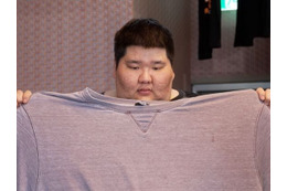 274kgの男性は15週で50kg減　世界が注目の“痩せ薬”ウゴービの明と暗、韓国の使用者に迫る 画像