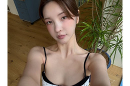 “パク・ソジュンとの熱愛説”で一躍時の人に、韓国美女ユーチューバーが流行りの歯科施術を報告 画像