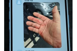 暴行の跡まで!! Ｊリーグのパワハラ問題に匹敵するか。韓国“ランシュー界の帝王”パワハラ事件の真相はいかに 画像