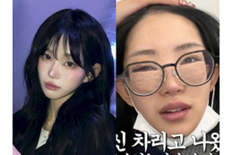 父は元巨人投手 韓国インフルエンサー、整形手術後の腫れた顔を赤裸々に公開 画像