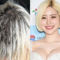 髪の90%が抜け落ち“対人恐怖症”にもなったDJ SODA、ブリーチ事故から1年…最新の髪型公開 画像