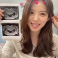 「夫と一緒にシャワー」発言で話題の韓国インフルエンサー、“8股”されていた過去を暴露 画像