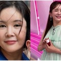 「本当に垢抜けた」整形を堂々公表、激変する前の姿を公開　二児の母でもある韓国女優 画像