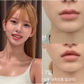 12年ぶりの整形は人中短縮「ママには内緒で」“韓国で最もグラマラス”な元芸人（40）が理由明かす 画像