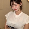 “韓国で最もグラマラス”な元芸人が12年ぶりに整形　手術1カ月後の顔を公開「満足度は…」 画像