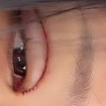 「地獄から」痛々しい手術痕…3度目となる目の整形手術を報告、父は元巨人投手の韓国インフルエンサー 画像