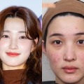 「育ててるのは元夫でしょ」元韓国アイドル、“育児で”ボロボロになった肌公開も視聴者は不快感
