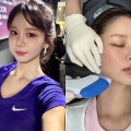 “韓国で最もグラマラス”と言われた元芸人、医師の年下彼氏に顔をお任せ!美容施術VLOGが話題