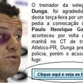 「ブラジル代表ドゥンガ監督、ファンから暴行！」……というメールに要注意、マカフィーが警告 画像