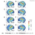 小学生、英単語を処理する脳活動の基本パターンを解明 平均的な賦活パターン