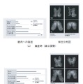 図2：筋肉負担検証試験と体圧分布