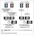 図6．超解像の効果̶ サイド バイ サイド方式の3D 映像を高画質に復元する。