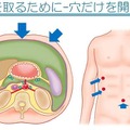 スライド例