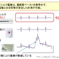 心電図計測例 