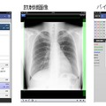 モバイル端末で閲覧可能な診療情報の一部（例） 